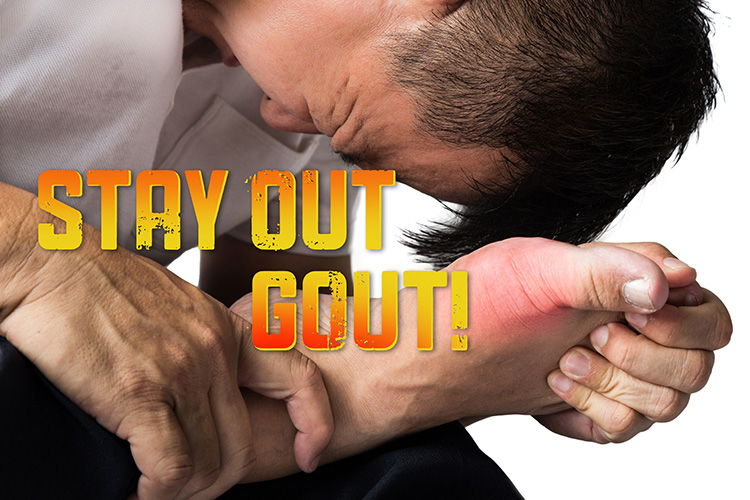 Stay Out, Gout! Reduce Your Risk